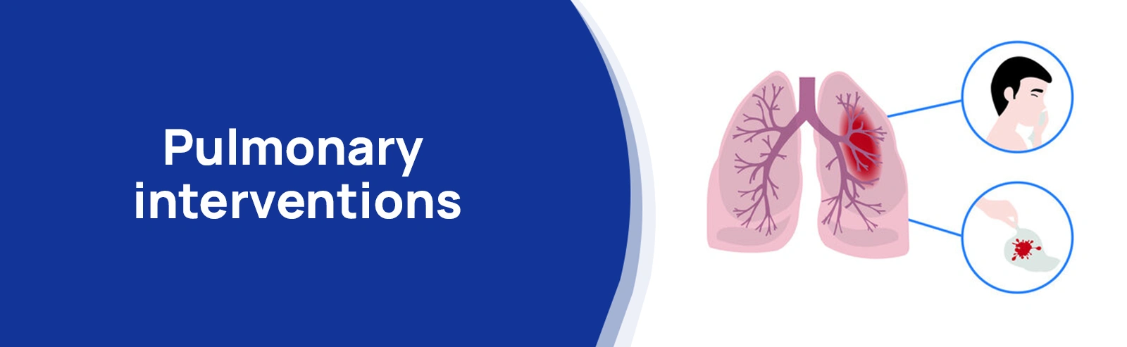 Pulmonary interventions 01